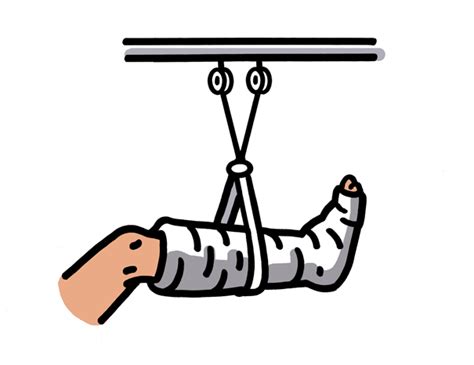 Injury Clipart Break Leg Injury Break Leg Transparent Free For