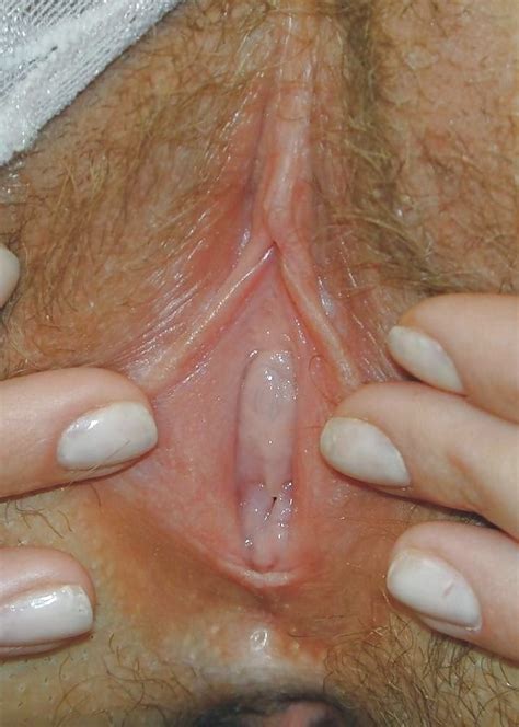 Pussy Labia And Clitoris Weird And Beautiful 64 Pics