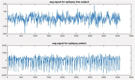 Eeg Signal For Epilepsy Free Subject And Epileptic Patient Download Scientific Diagram