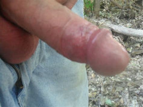 Lamontals Photo Album My Semi Erect Penis 1 Xtube