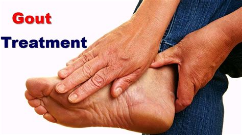 Gout Treatment Naturally How To Cure Gout In 24 Hours Naturally Find