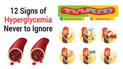 Printable Hyperglycemia Signs And Symptoms