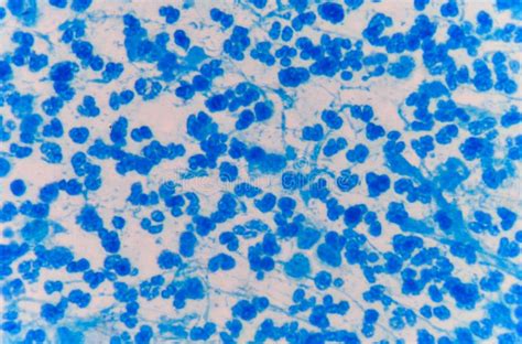 528 Blue Blood Cells Photos Free And Royalty Free Stock Photos From
