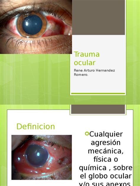 Causes Of Ocular Trauma Pk