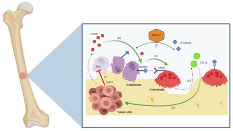 Cancers Free Full Text Bone Targeting Agents In Patients With