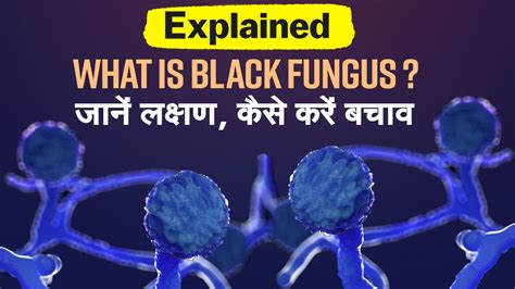 Black Fungus Explained Video में जानें ब्लैक फंगस के लक्षण कैसे करें बचाव