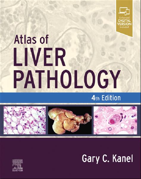 Atlas Of Liver Pathology 4th Edition Gary C Kanel Relié Elsevier