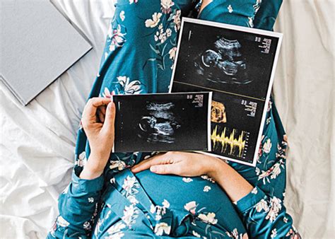 تعداد دفعات مجاز سونوگرافی در بارداری نرم افزار بارداری پرگ Preg