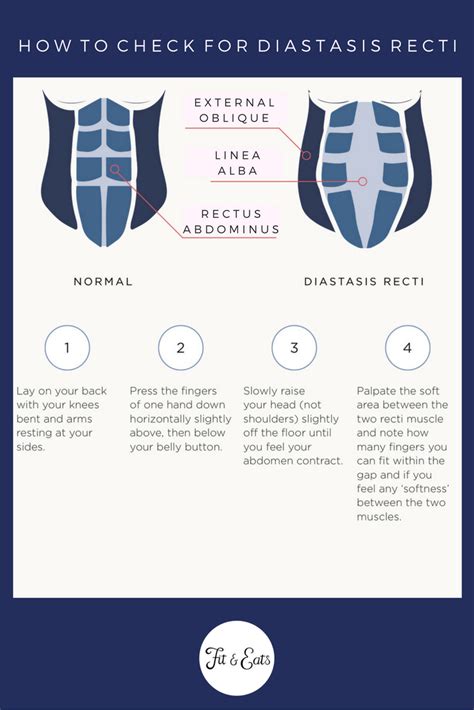 How To Check For Diastasis Recti Video Included — Fit And Eats