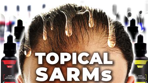 The Therapeutic Promise Of Topical Sarms For Hair Loss Prevention