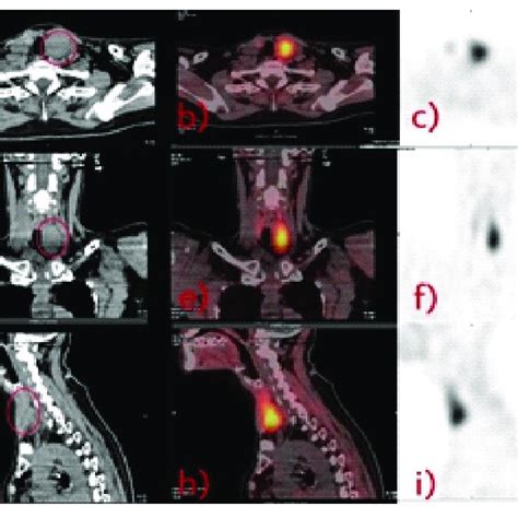 A D And G Showing Soft Tissue Computed Tomography Scan Of The Left