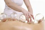 Cupping Glass Therapy Images