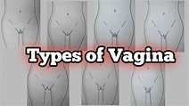 Types of Vagina | vagina types | different vagina | vagina | for ...