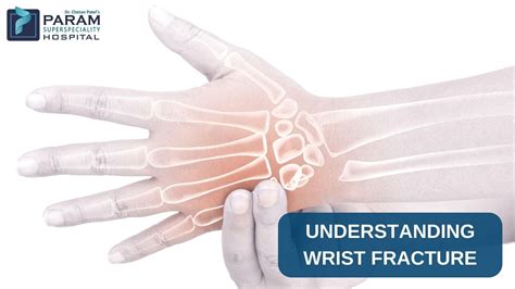 Understanding Wrist Fractures Types Causes And Symptoms Param