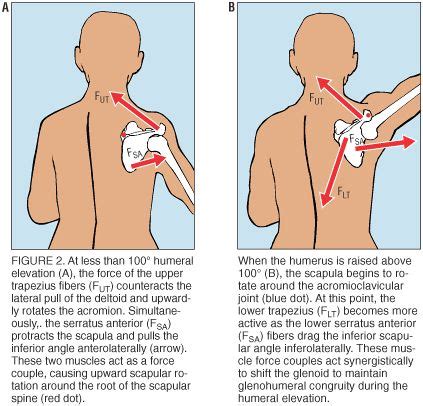 While shoulder impingement can be painful and affect your daily activities, most people make a full recovery within a few months. 17 Best images about Upper Extremity on Pinterest ...