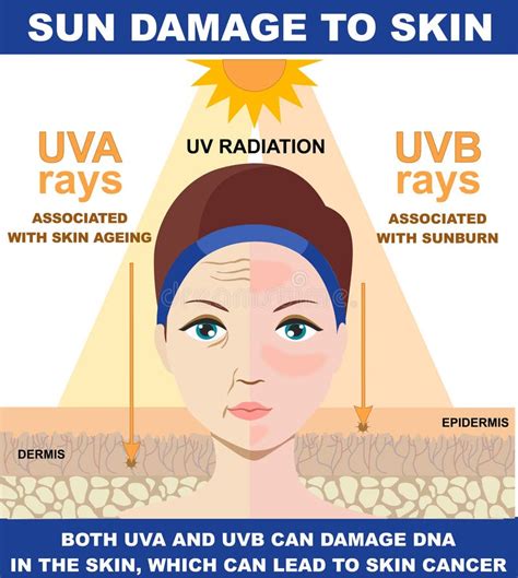 Sun Damage To Skinthe Difference Of Radiation 2 Types In Sunlight