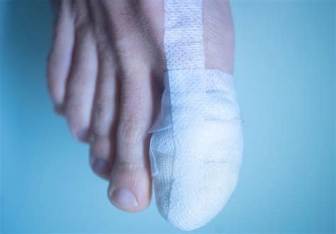 Sprained Big Toe Vs Broken Big Toe How To Tell The Difference And What