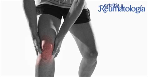 señales de una posible rotura de ligamento de la rodilla
