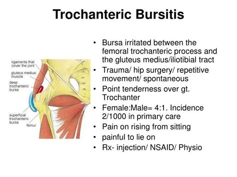 Hip Pain And Bursitis The Hip Flexor