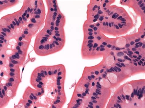 Pathology Outlines Histology Small Intestine