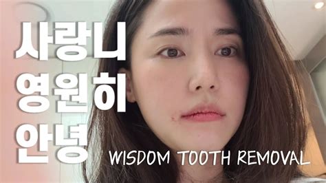 A lil 7 day vlog of my wisdom teeth removal recovery!! Eng) 사랑니 뽑으셨나요? 공현주 '매복사랑니 발치 수술' 리얼후기 1편 첫째날~DAY 1 ...