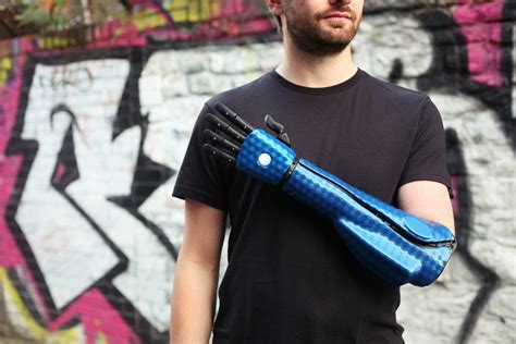 Prosthetic Arm Covers