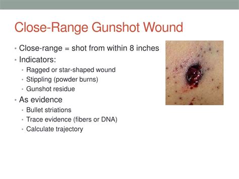 Ppt Cause Of Death Wounds Powerpoint Presentation Free Download