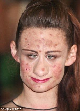 The Zit Parade New Iphone App Transforms Even Hollywood S Most Beautiful Faces Into Spotty