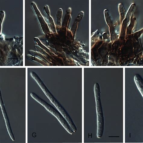 Cladosporium Echinulatum A Conidiophores B Small Conidia And