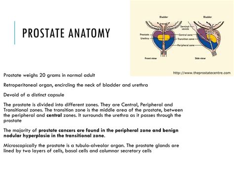 Ppt Prostate Pathology Powerpoint Presentation Free Download Id