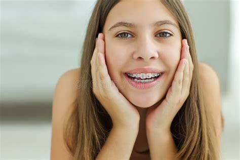 Close Up Portrait Of Smiling Teenager Girl Showing Dental Braces On