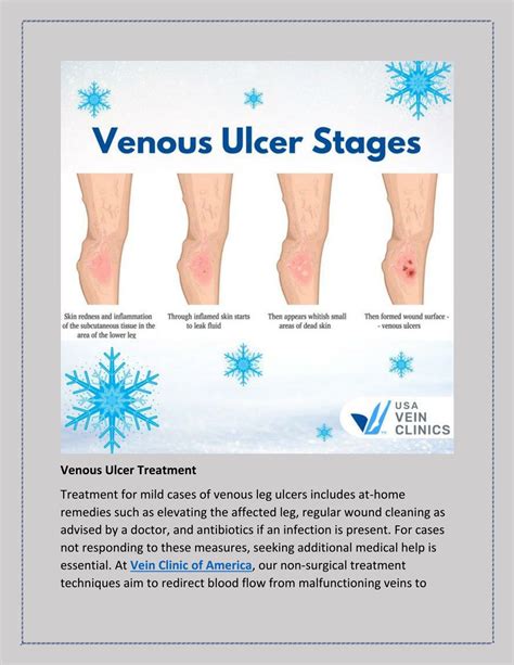 Ppt The Development Of A Venous Leg Ulcer Stages And Treatment Powerpoint Presentation Id