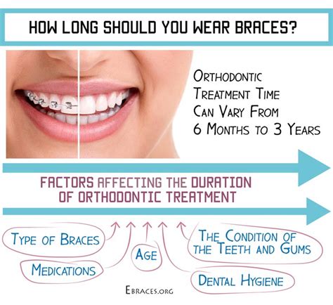 How Long Do You Have To Wear Braces For An Overbite When To Get
