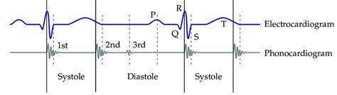 Wiggers Diagram The Blue Curve Shows The Ecg And The Grey Curve The