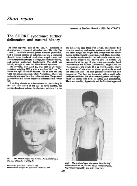 The Short Syndrome Further Delineation And Natural History Journal