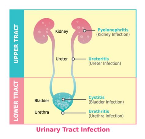 Understanding Uti Utipure The Trusted Urinary Alkalinizer For Womens Urinary Tract