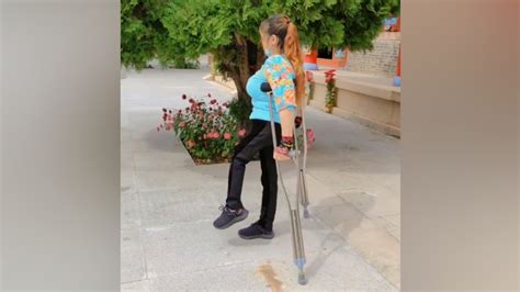 Polio Lady Sightseeing Tour On Underarm Crutches Short Leg Woman Youtube