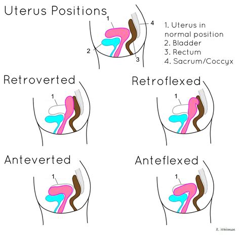 Female Pelvis And Female Reproductive System Beatas Dms Eportfolio