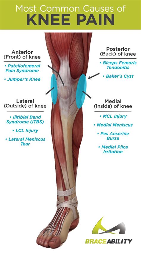 Right Knee Pain Location Chart