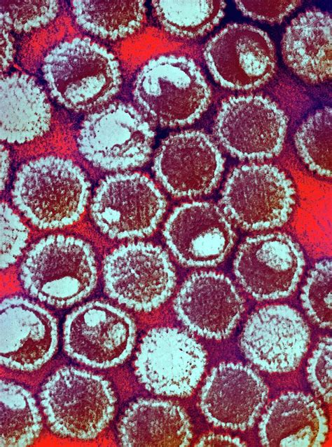 Herpes Virus Particles Photograph By Ami Imagesscience Photo Library