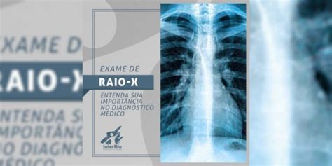Exame de raio x entenda sua importância no diagnóstico médico