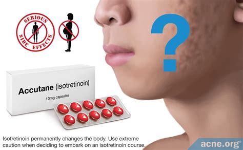 Does Isotretinoin Help With Acne Scars