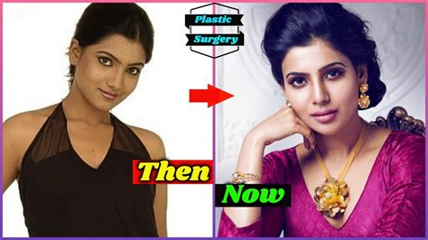 Shocking Plastic Surgery Of South Indian Actresses Before And After Samantha Akkineni Rashmika