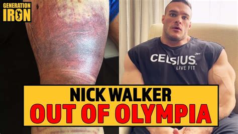 Nick Walker Out Of 2023 Olympia Due To Torn Hamstring Gi News Youtube
