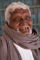How To Cure Leprosy - What is leprosy? - The Leprosy Mission Australia ...