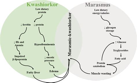 Kwashiorkor Pathophysiology