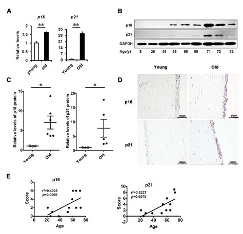 TGF-β and NF-κB signaling pathway crosstalk potentiates corneal