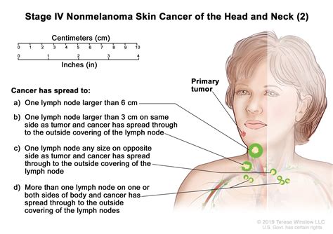 Skin Cancer Treatment Pdq®patient Version Nci