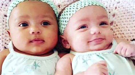 Biracial Twins Born With Different Complexions Become Social Media
