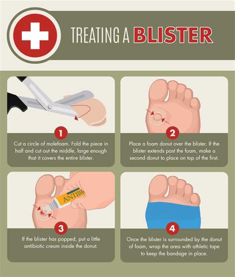 The Ultimate Wilderness First Aid Guide